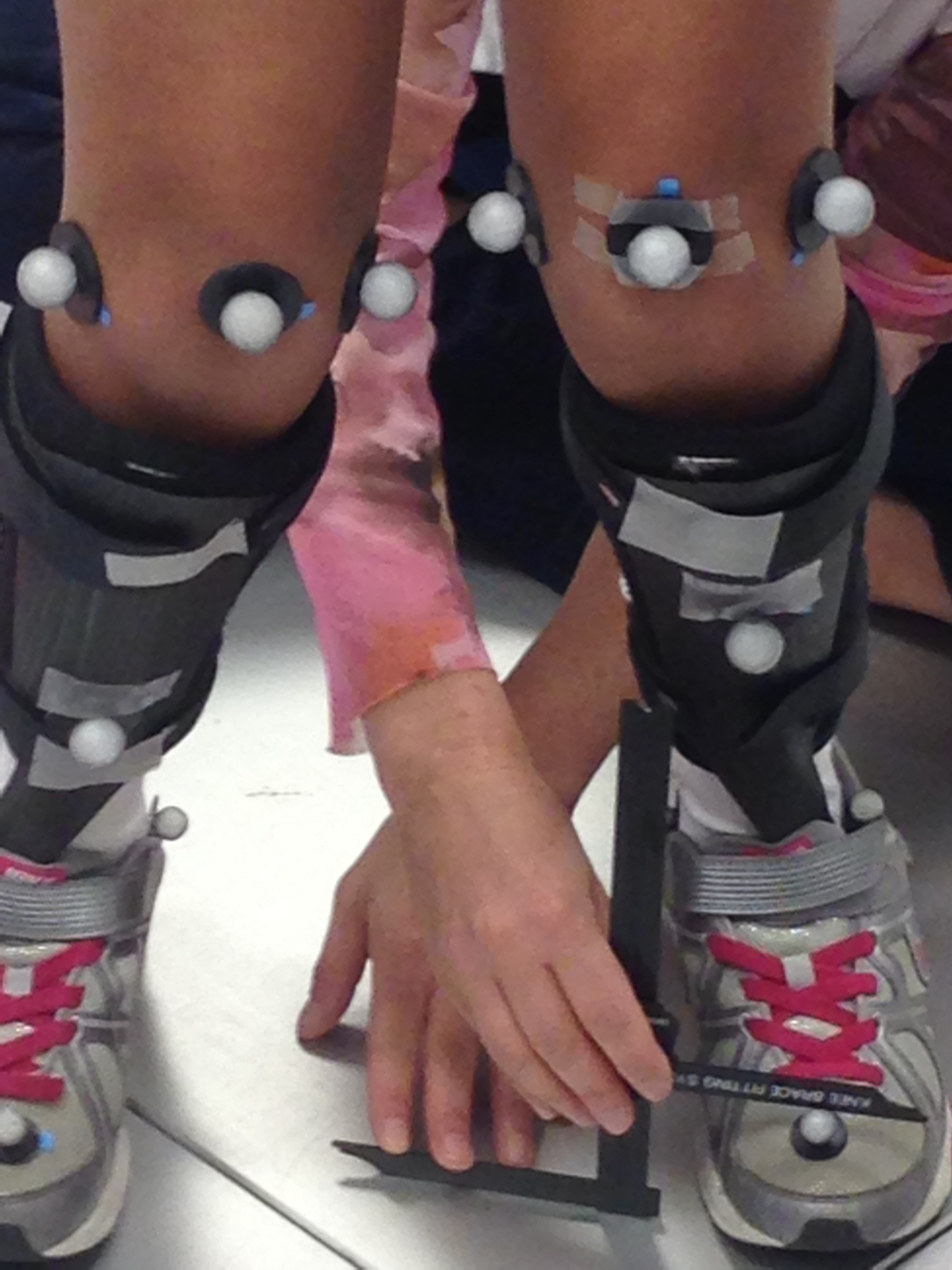 Reflective balls being placed throughout body for precise measurements of joint motion